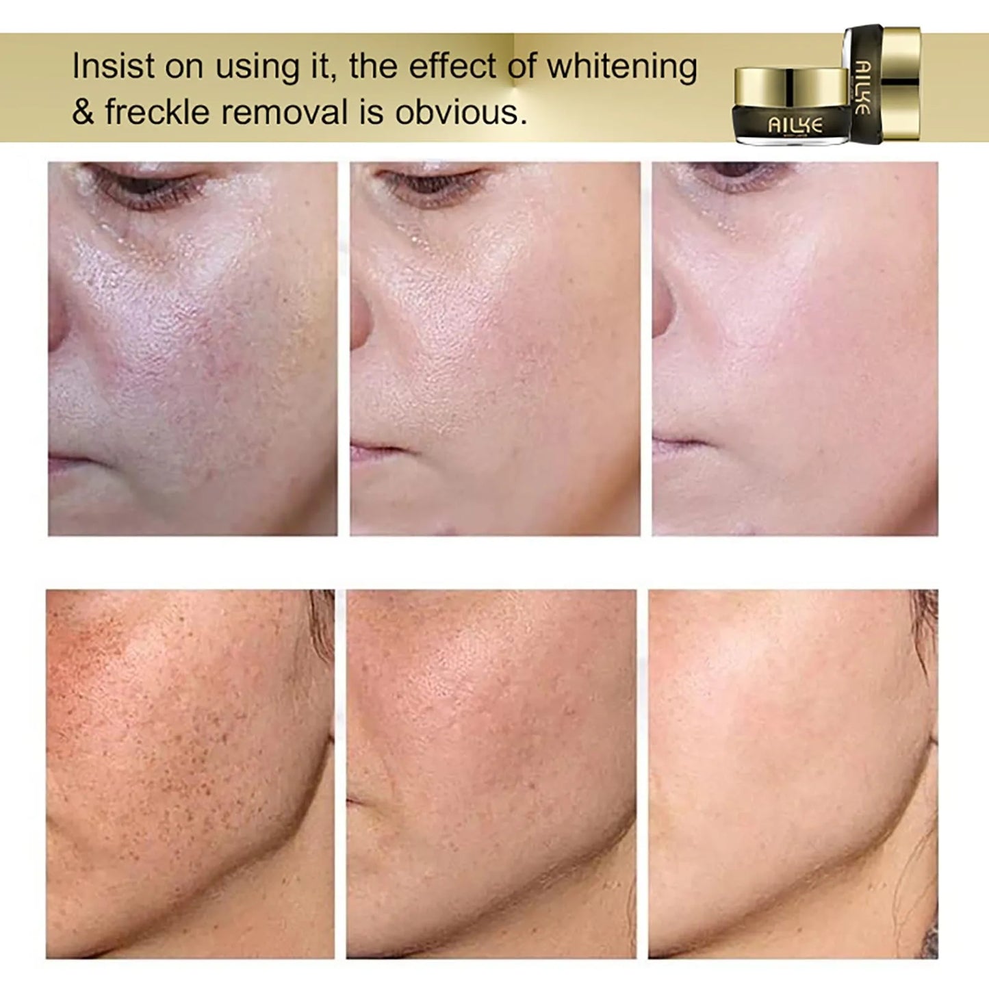 AILKE Whitening And Removing Freckle Cream
