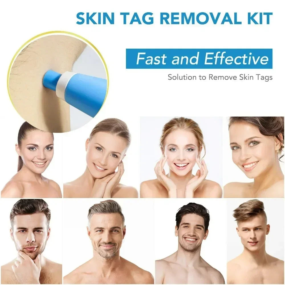 Auto Skin tag remover kit