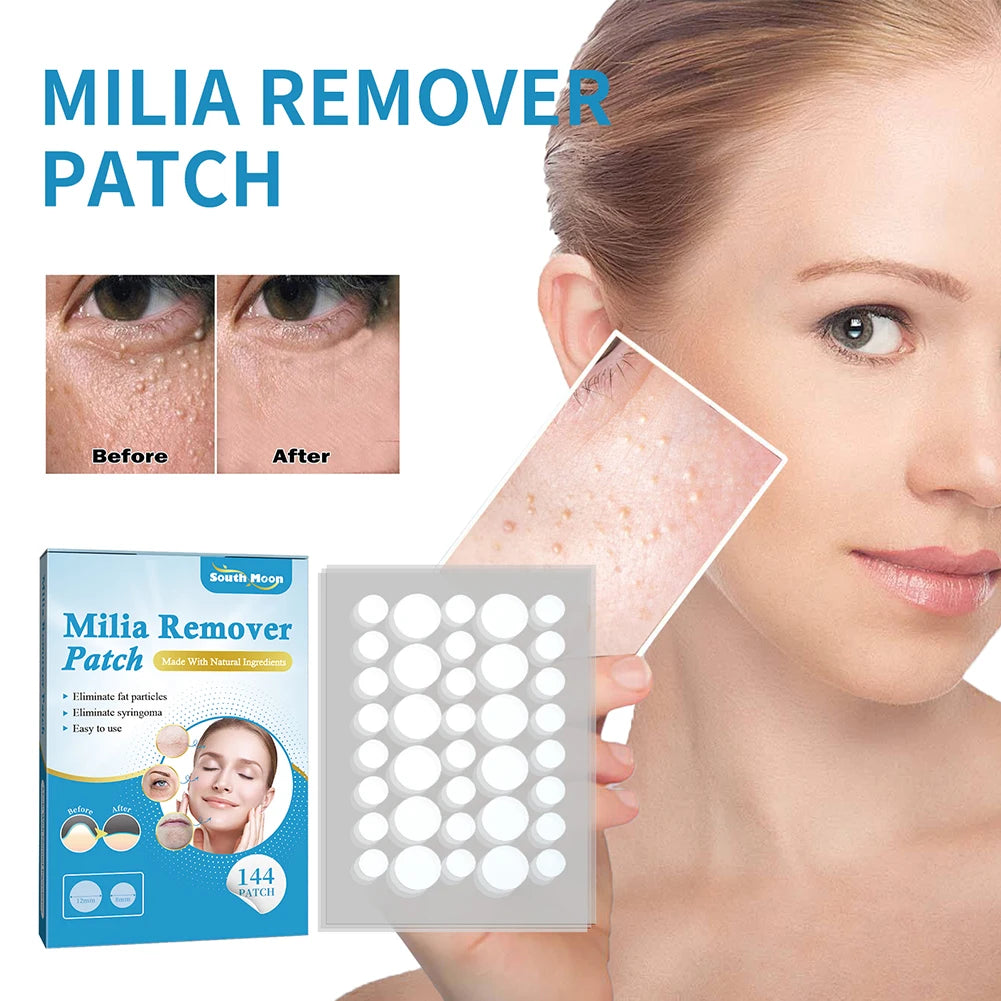 144Pcs Patch Remover