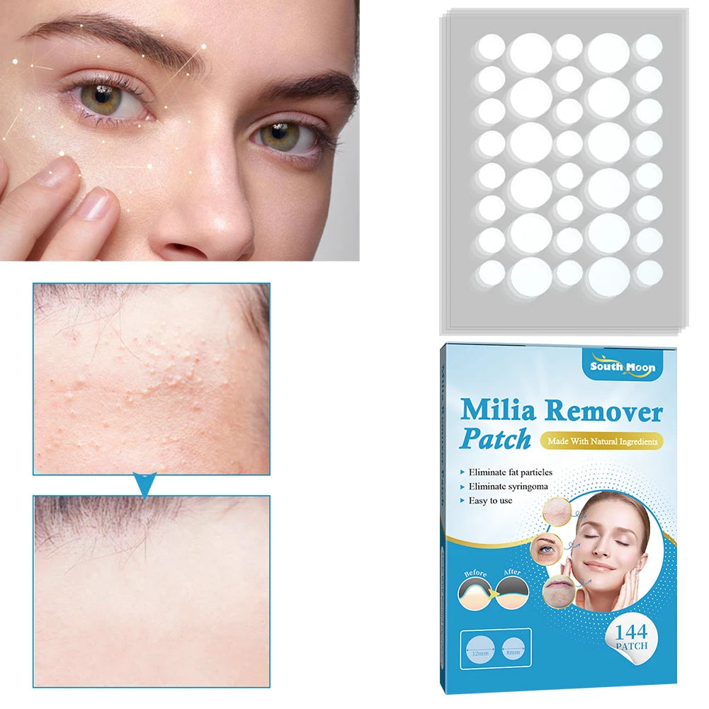 144Pcs Patch Remover
