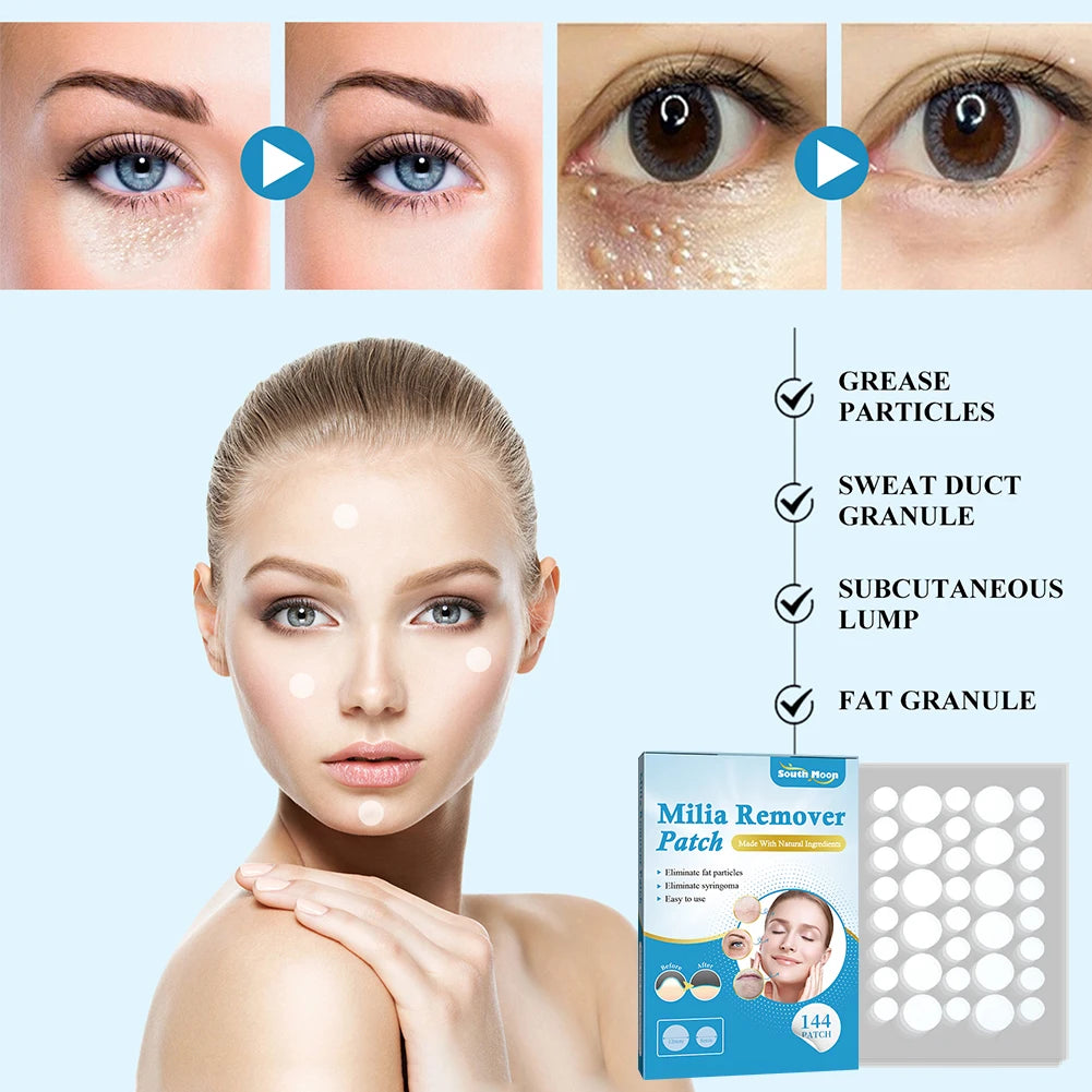 144Pcs Patch Remover